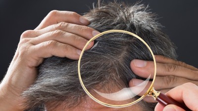 보이지 않는 두피 생태계의 비밀