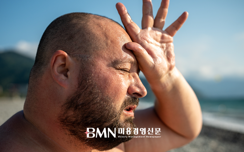 폭염에 지친 두피... 여름철 올바른 관리가 건강한 모발 좌우한다